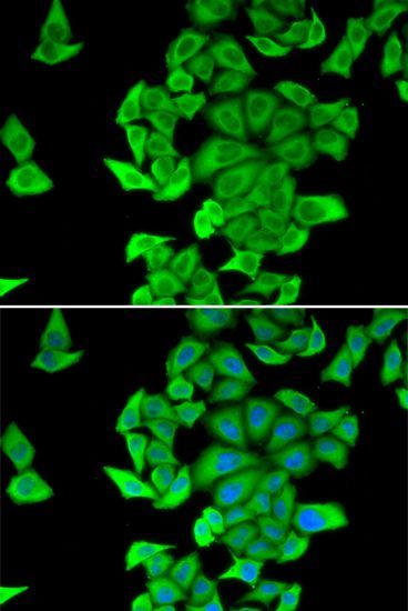 Immunofluorescence - SMYD2 Polyclonal Antibody (144-06474)