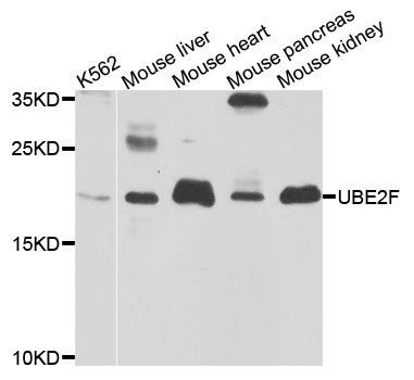 Western blot - UBE2F antibody (144-05160)