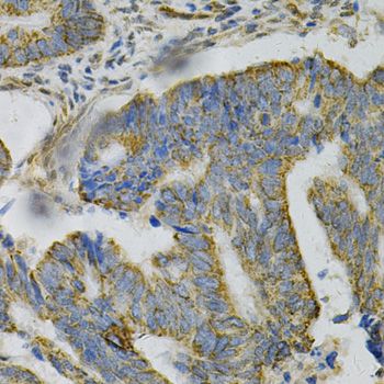 Immunohistochemistry - AK1 Polyclonal Antibody (144-603440)