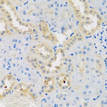 Immunohistochemistry - DNAL1 antibody (144-08267)