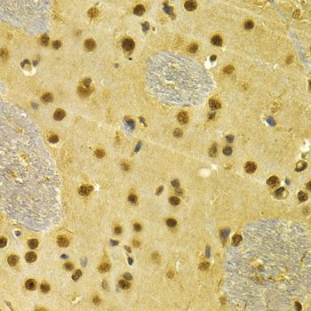 Immunohistochemistry - RUNX1 Antibody (144-02055)