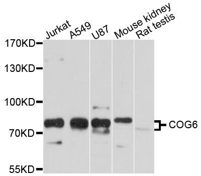 Western blot - COG6 Polyclonal Antibody (144-010319)