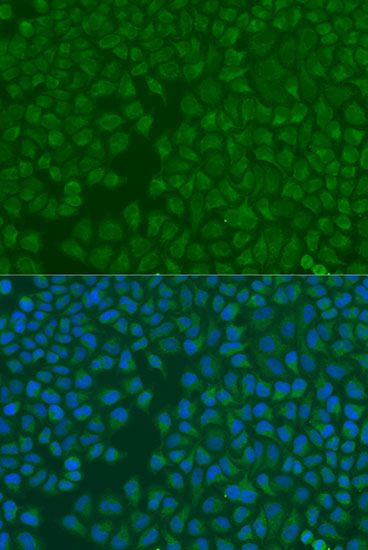 Immunofluorescence - BNIP3 Polyclonal Antibody (144-05683)