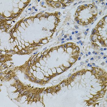 Immunohistochemistry - SIGMAR1 antibody (144-05479)