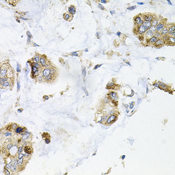 Immunohistochemistry - GALC antibody (144-03873)
