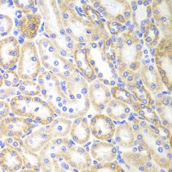 Immunohistochemistry - SIRT3 Polyclonal Antibody (144-07307)
