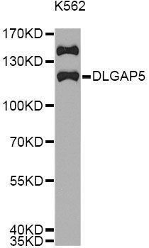Western blot - DLGAP5 antibody (144-02197)