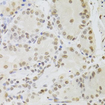 Immunohistochemistry - RUVBL1 Antibody (144-05723)