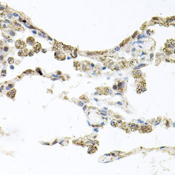 Immunohistochemistry - PIK3CB antibody (144-00982)