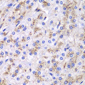 Immunohistochemistry - CTSD antibody (144-60266)