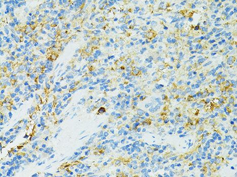 Immunohistochemistry - CD19 antibody (144-02577)