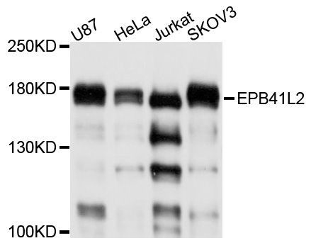 Western blot - EPB41L2 antibody (144-09101)
