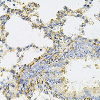Immunohistochemistry - UBE2B Antibody (144-06315)