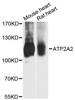 Western blot - ATP2A2 Polyclonal Antibody (144-00098)