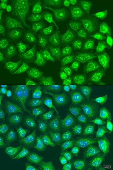 Immunofluorescence - SPICE1 antibody (144-07855)