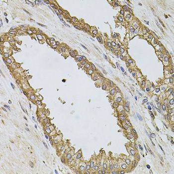 Immunohistochemistry - PIK3CA Polyclonal Antibody (144-00265)