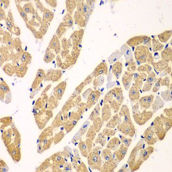 Immunohistochemistry - KYNU antibody (144-06643)