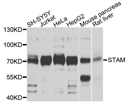 Western blot - STAM antibody (144-04198)