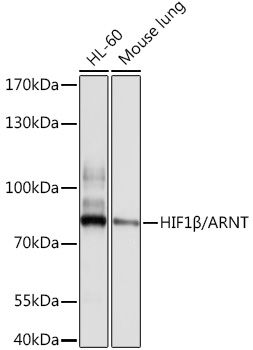 Western blot