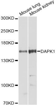 Western blot - DAPK1 Polyclonal Antibody (144-05741)