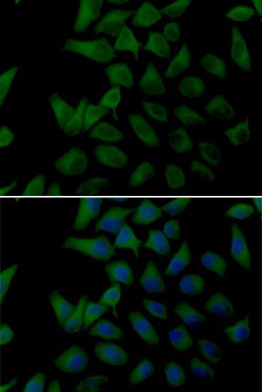 Immunofluorescence - PLOD2 antibody (144-06946)