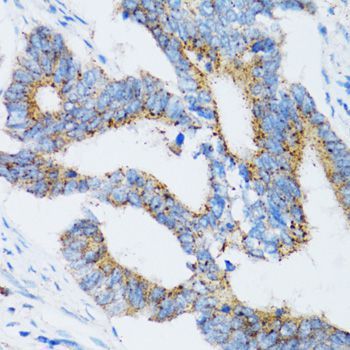 Immunohistochemistry - SIAH1 antibody (144-02494)