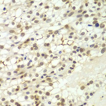 Immunohistochemistry - LHX4 antibody (144-08072)
