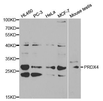 Western blot - [KO Validated] PRDX4 Polyclonal Antibody (144-01486)