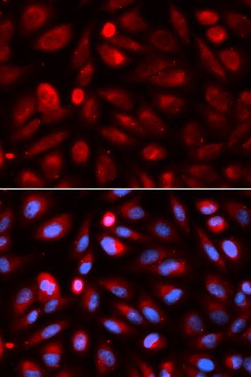 Immunofluorescence - ACP5 antibody (144-02528)