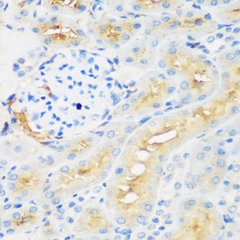 Immunohistochemistry - PROCR antibody (144-60426)