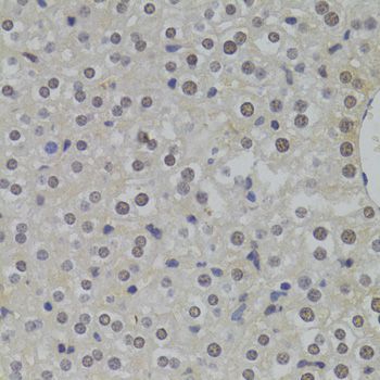 Immunohistochemistry - HNRNPA1 Polyclonal Antibody (144-07491)