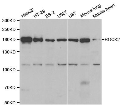 Western blot - ROCK2 Polyclonal Antibody (144-05698)