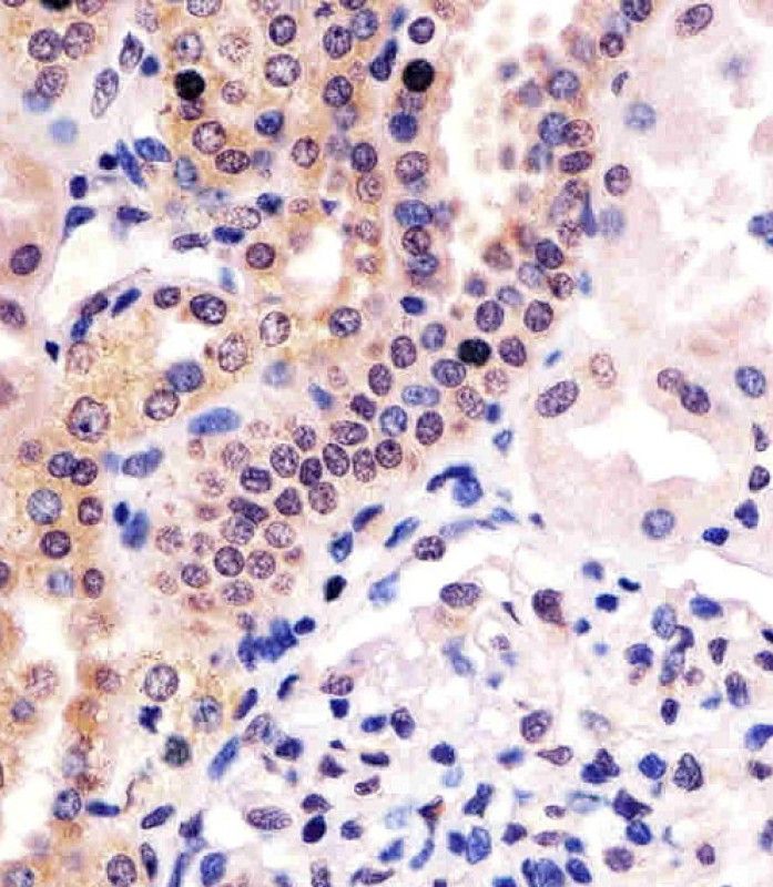IHC-P
