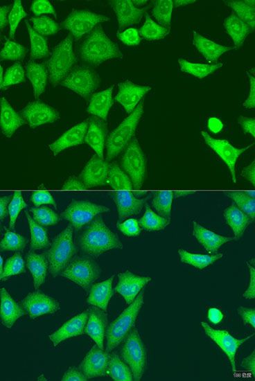 Immunohistochemistry - [KO Validated] Eif2ak2 Polyclonal Antibody (144-05578)