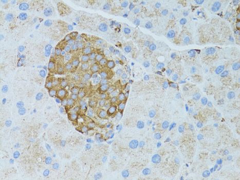 Immunohistochemistry - OCLN antibody (144-02601)