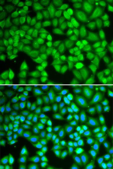 Immunofluorescence - WAS Polyclonal Antibody (144-00978)