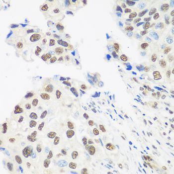 Immunohistochemistry - DDX39B Polyclonal Antibody (144-08356)
