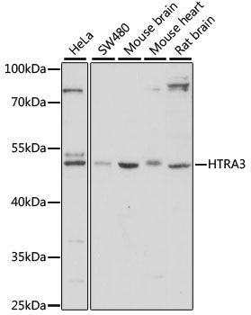 Western blot - HTRA3 Polyclonal Antibody (144-60735)