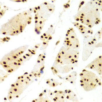 Immunohistochemistry - ELAVL1 Polyclonal Antibody (144-01608)