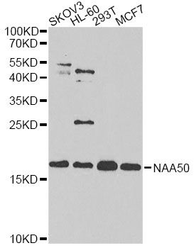 Western blot - NAA50 antibody (144-61406)