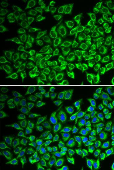Immunofluorescence - IL12RB1 antibody (144-01886)