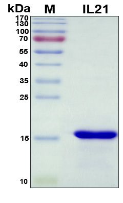 SDS-PAGE