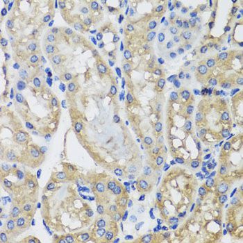 Immunohistochemistry - MRPS22 antibody (144-08319)