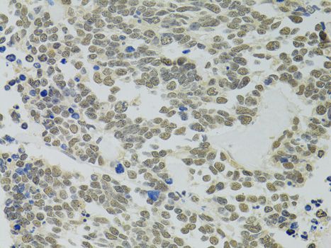 Immunohistochemistry - PPP4C Polyclonal Antibody (144-02109)
