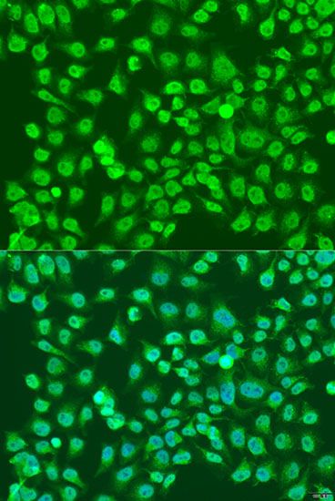 Immunofluorescence - NPR3 antibody (144-08138)