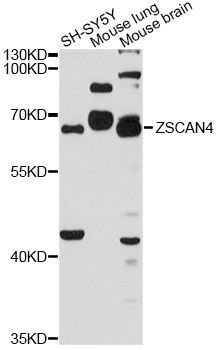 Western blot - ZSCAN4 antibody (144-60079)