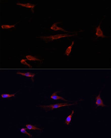 Immunofluorescence - [KO Validated] EGFR Polyclonal Antibody (144-11351)