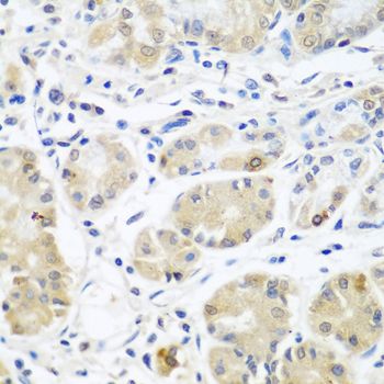 Immunohistochemistry - EIF3A Polyclonal Antibody (144-00573)