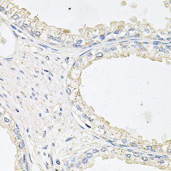Immunohistochemistry - EPOR Polyclonal Antibody (144-02917)