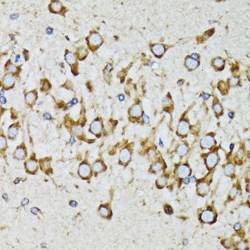 Immunohistochemistry - RPN1 antibody (144-600827)